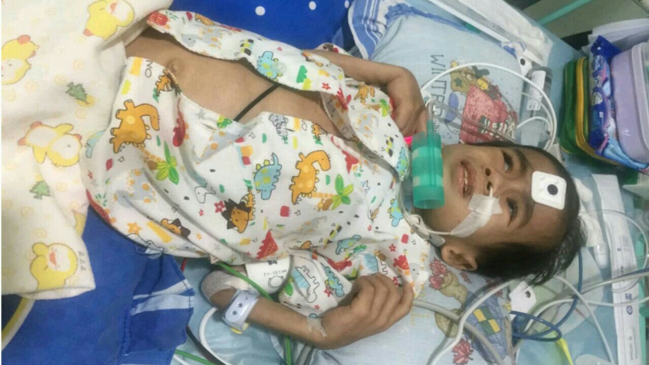 Inilah Penyakit Langka Bayi Cio