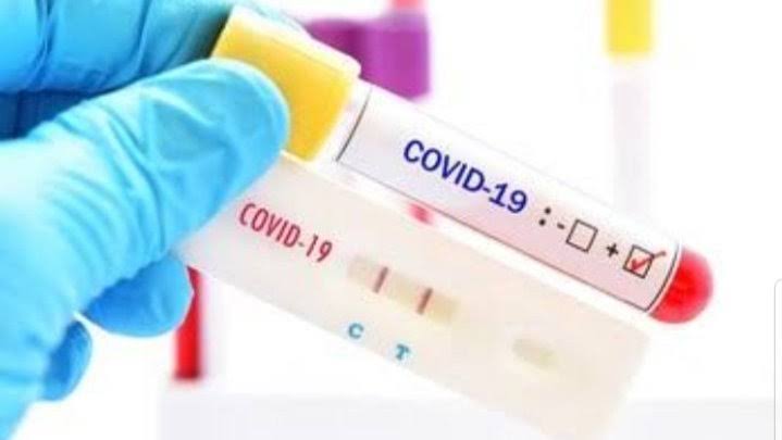 Dua Warga Barsel Dipastikan Postifi Corona