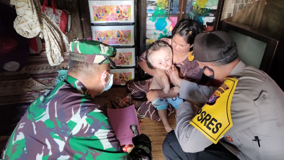 Bayi Penderita Hydrocephalus Dapat Santunan Dua Perwira Bayi Penderita Hydrocephalus Dapat Santunan Dua Perwira